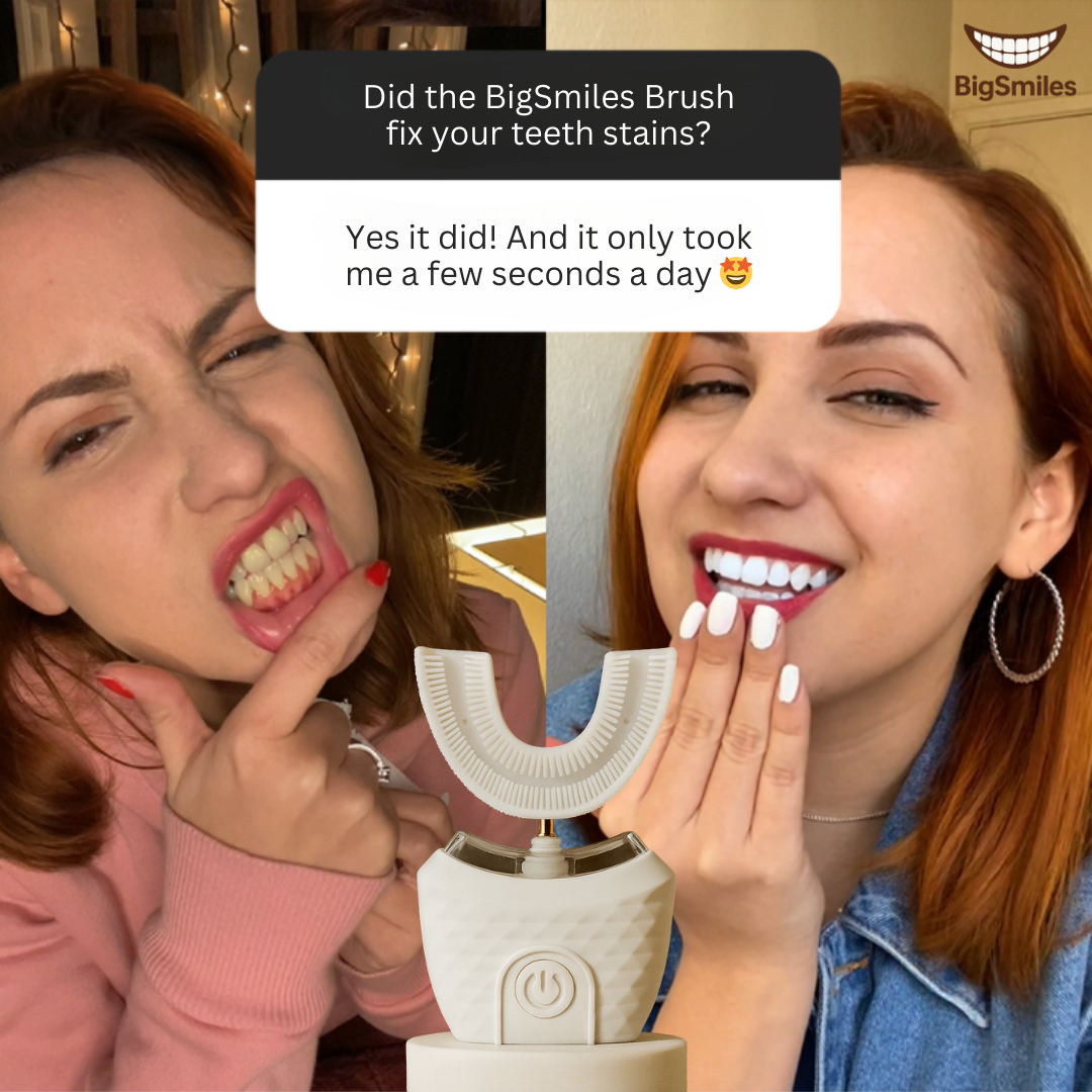 BigSmiles Brush
